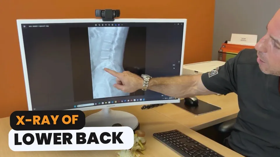 Lower Back X-Ray