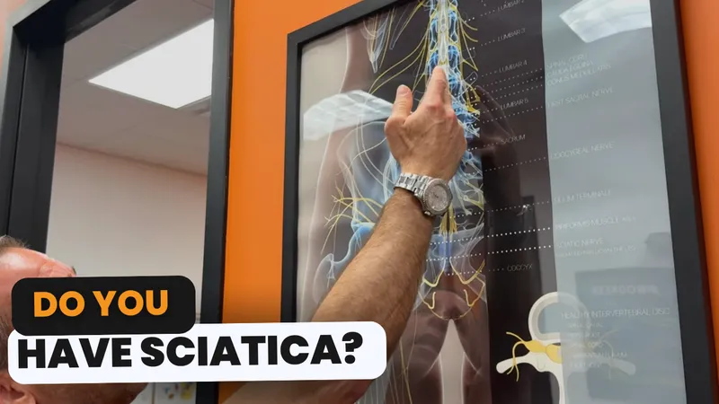 Sciatica video