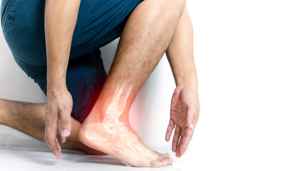 chiropractic treatment for leg pain delray beach